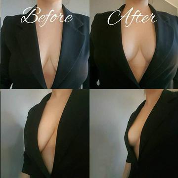 Invisible foil for breast lifting - size 10 cm